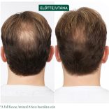 Matrix Biolage Full Rescue hajhullás elleni ampulla kúra 10X6ml