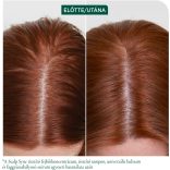 Matrix Biolage ScalpSync Anti-Dandruff sampon korpásodás ellen 400 ml