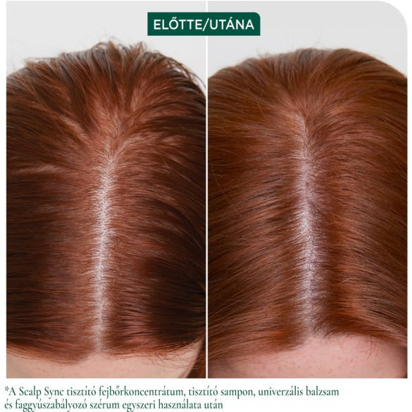 Matrix Biolage ScalpSync Anti-Dandruff sampon korpásodás ellen 400 ml